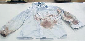 Bloody Shirt